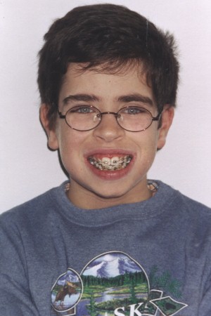 Jeremy's braces.jpg (31956 bytes)